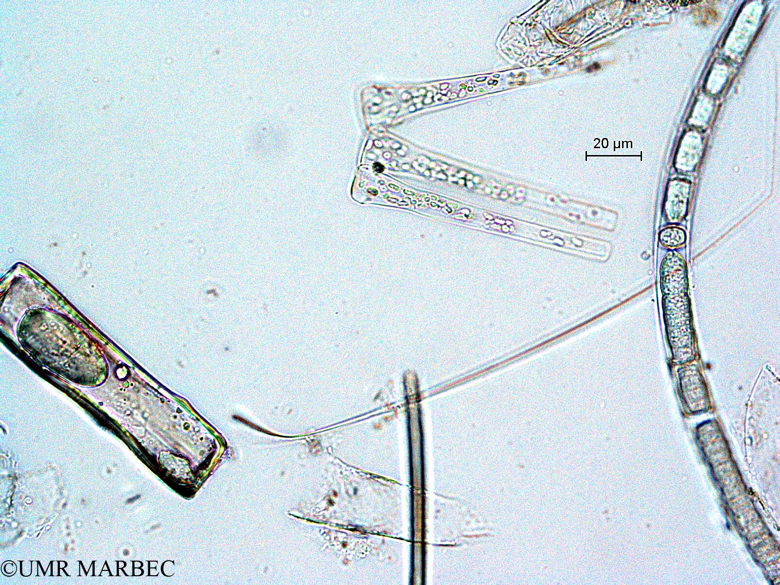 phyto/Scattered_Islands/all/COMMA April 2011/Asterionella bleakeleyi var. notata (ancien Bleakeleya sp)(copy).jpg
